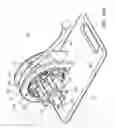 Fig. 10 - Tissue prosthesis processing technology