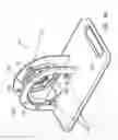Fig. 14 - Tissue prosthesis processing technology