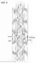 Fig. 09 - Movable tensegrity structure