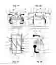 Fig. 10 - Method and device for inserting (tube) bags into cartons