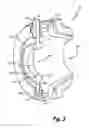 Fig. 04 - Fuel nozzle guide plate mistake proofing