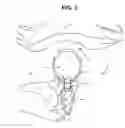 Fig. 04 - ARTICLE FOR LOCKING AN ACCESSORY TO A PHYSICAL STRUCTURE USING A SEPARATE LOCKING DEVICE AND THE COMBINATION THEREOF