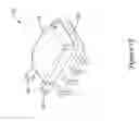 Fig. 06 - Sensor package assembly having an unconstrained sense die