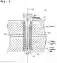 Fig. 04 - INSULATOR FOR SPARK PLUG, PROCESS FOR PRODUCING THE INSULATOR, SPARK PLUG, AND PROCESS FOR PRODUCING THE SPARK PLUG
