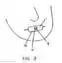 Fig. 03 - Nasal devices with respiratory gas source
