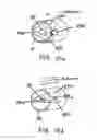Fig. 11 - Nasal devices with respiratory gas source