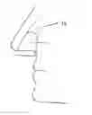 Fig. 01 - Methods of treating a sleeping subject