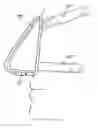 Fig. 01 - Methods of treating a disorder by inhibiting expiration