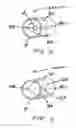 Fig. 09 - Methods of treating a disorder by inhibiting expiration