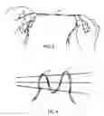 Fig. 04 - Hair weaving apparatus and method for making and using