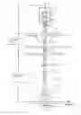 Fig. 02 - Riser system comprising pressure control means