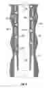 Fig. 07 - Method and system for anchoring and isolating a wellbore