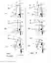 Fig. 04 - AERATOR MECHANISM WITH VERTICALLY RECIPROCATING TINE