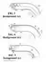 Fig. 03 - Toneable conduit with heat treated tone wire