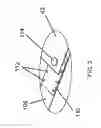 Fig. 03 - Flexible retractable transfer device metering apparatus and methods