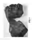 Fig. 02 - Delayed coking process