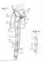 Fig. 03 - BACKPACK