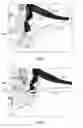 Fig. 04 - Apparatus and method for stowing suspension lines