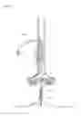 Fig. 07 - Portable multi-purpose mast for rapid, secure attachment to unsteady, inclined and irregular surfaces