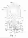 Fig. 15 - Transferable patient care equipment support