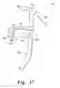 Fig. 18 - Transferable patient care equipment support