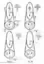 Fig. 10 - One piece flexible skateboard