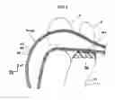 Fig. 05 - Occupant restraining device for a vehicle