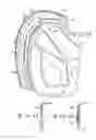 Fig. 06 - Multi-piece vehicle wheel cover retention system and method for producing same