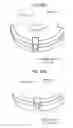 Fig. 06 - Motor with case lid fixing structure