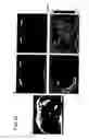 Fig. 18 - Device and method for generating mechanical oscillations in an examination object using magnetic resonance elastography