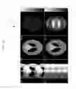Fig. 14 - Systems and methods for accelerating the acquisition and reconstruction of magnetic resonance images with randomly undersampled and uniformly undersampled data
