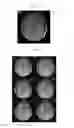 Fig. 15 - Systems and methods for accelerating the acquisition and reconstruction of magnetic resonance images with randomly undersampled and uniformly undersampled data