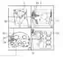 Fig. 01 - Method for Supporting Puncture Planning in a Puncture of an Examination Object