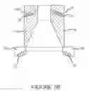 Fig. 09 - Systems and methods for the inspection of stents
