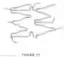 Fig. 13 - Systems and methods for the inspection of stents
