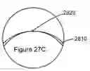 Fig. 01 - Multifocal lens having a progressive optical power region and a discontinuity