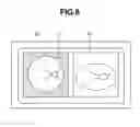Fig. 09 - Fundus camera