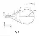 Fig. 07 - Device for optical distance measurement