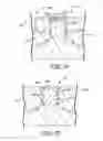 Fig. 09 - Protected transducer for dead layer reduction