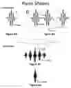 Fig. 08 - Phase-matched generation of coherent soft and hard X-rays using IR lasers