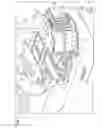 Fig. 03 - Radiation therapy device