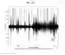 Fig. 14 - Wind noise classifier