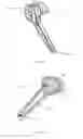 Fig. 02 - Speaker Capacitive Sensor