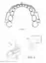 Fig. 07 - INTRA-ORAL BRACKETS FOR TRANSMITTING VIBRATIONS