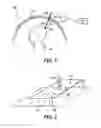 Fig. 02 - METHOD AND SYSTEM FOR MEASURING AN OBJECT OF INTEREST