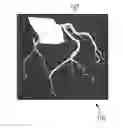 Fig. 01 - Method and device for post-processing measured values registered by way of an imaging system