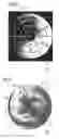 Fig. 04 - Method and device for post-processing measured values registered by way of an imaging system