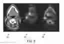Fig. 09 - Method and System for Database-Guided Lesion Detection and Assessment