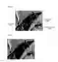 Fig. 11 - APPARATUS FOR REMOVING IMAGE NOISE AND METHOD THEREOF