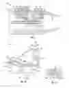 Fig. 02 - Engine case system for a gas turbine engine